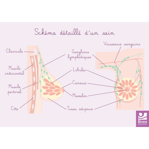 Schéma détaillé d'un cancer du sein